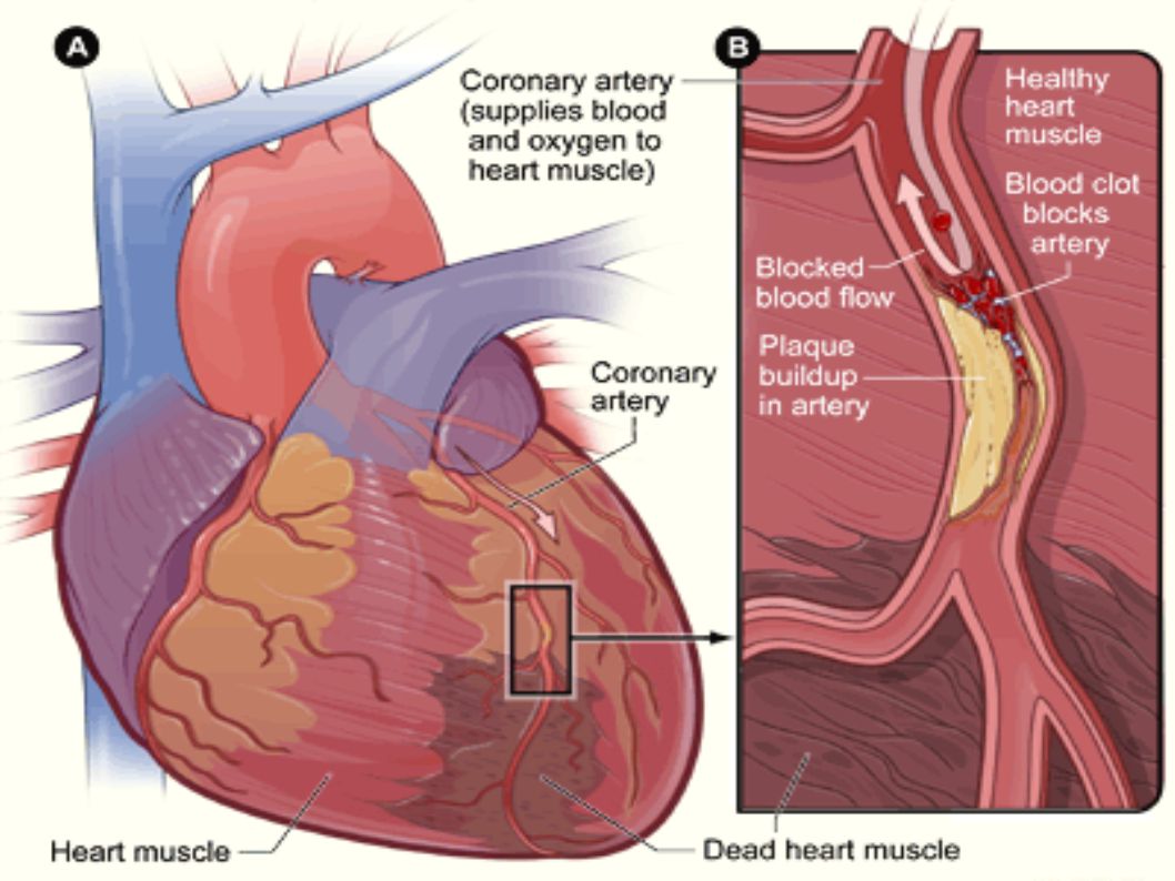 Scoperti i meccanismi grazie a cui l'Extravergine riduce il rischio di infarto 