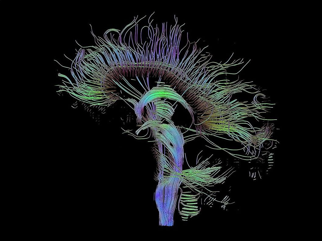 Nell'Extravergine è presente un composto che è in grado di ritardare il Parkinson