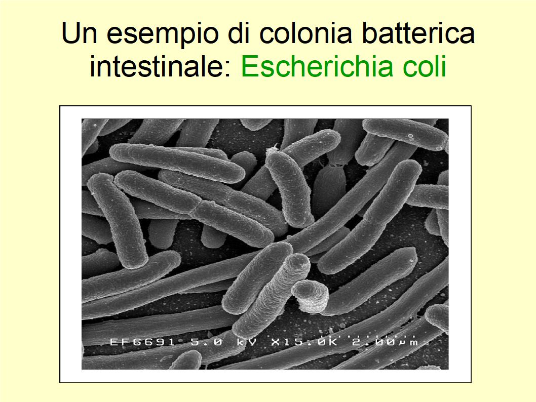 Nel prevenire il tumore intestinale l'Extravergine non ha rivali