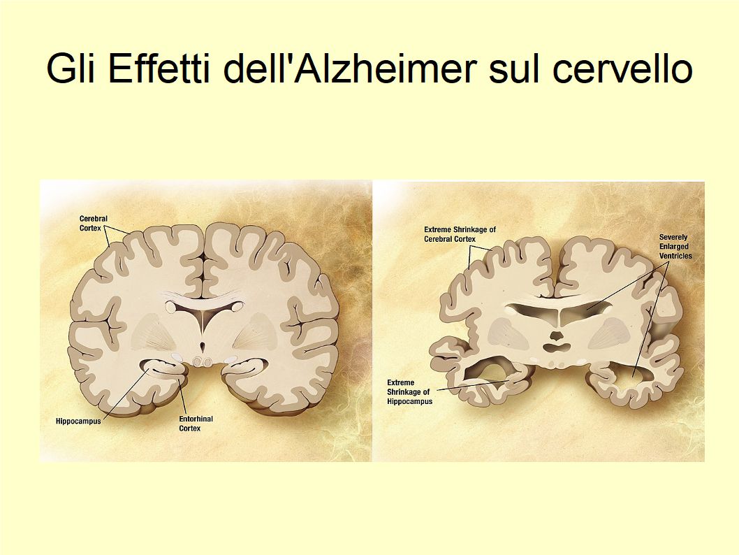 I benefici dell'Extravergine contro il Declino Cognitivo