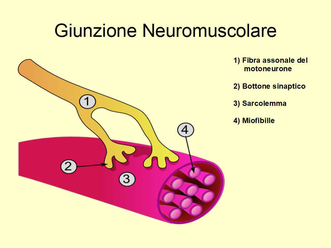 L'Acido Oleico ha un ruolo nella prevenzione della Sclerosi Multipla