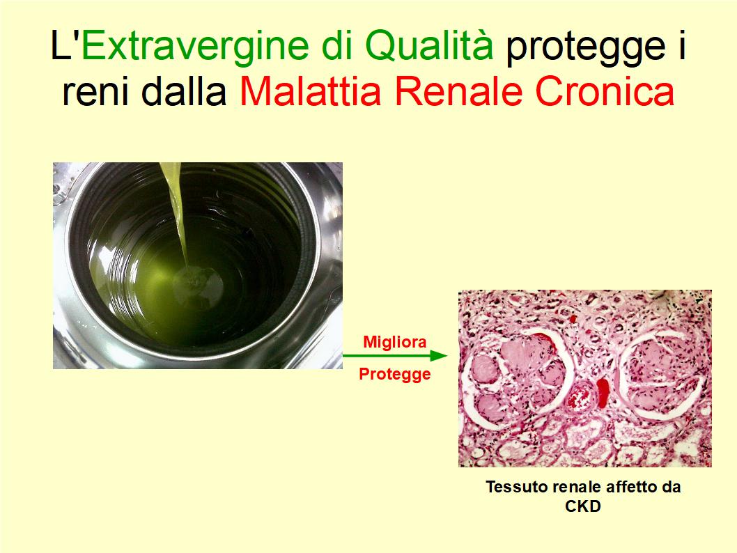 L'Extravergine di Alta Qualità aiuta prevenire la Malattia Renale Cronica