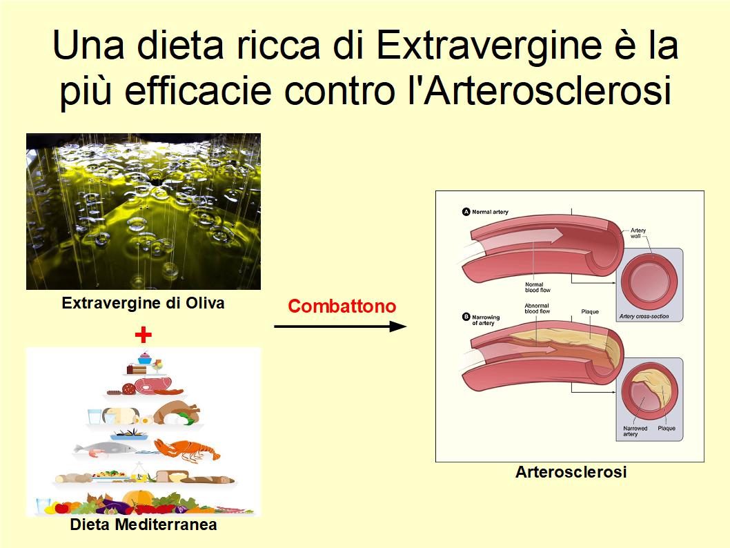 Una dieta ricca di Extravergine è efficacie nel ridurre l'arteriosclerosi