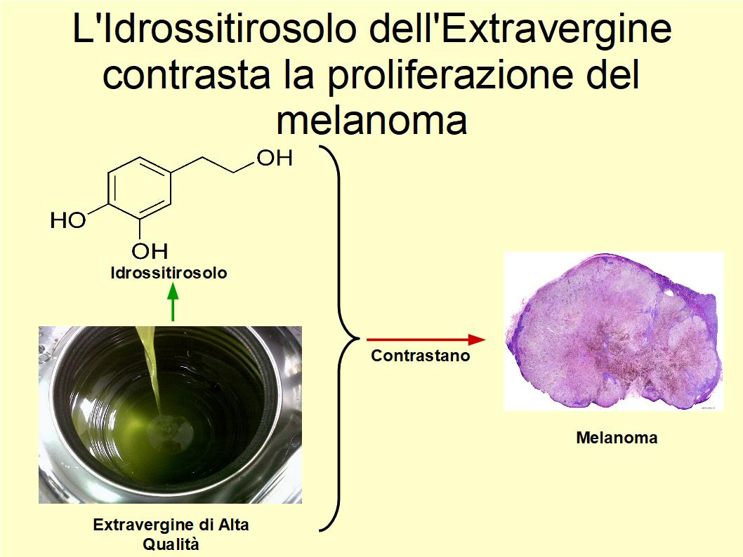 L’Idrossitirosolo dell’Extravergine contrasta la proliferazione di alcune cellule tipiche del melanoma