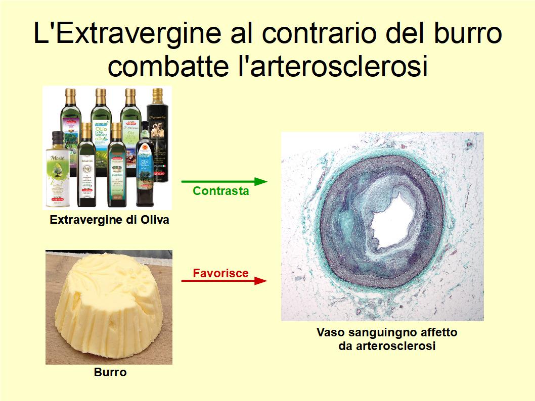 L’Extravergine ha un effetto positivo sulle nostre arterie al contrario del burro