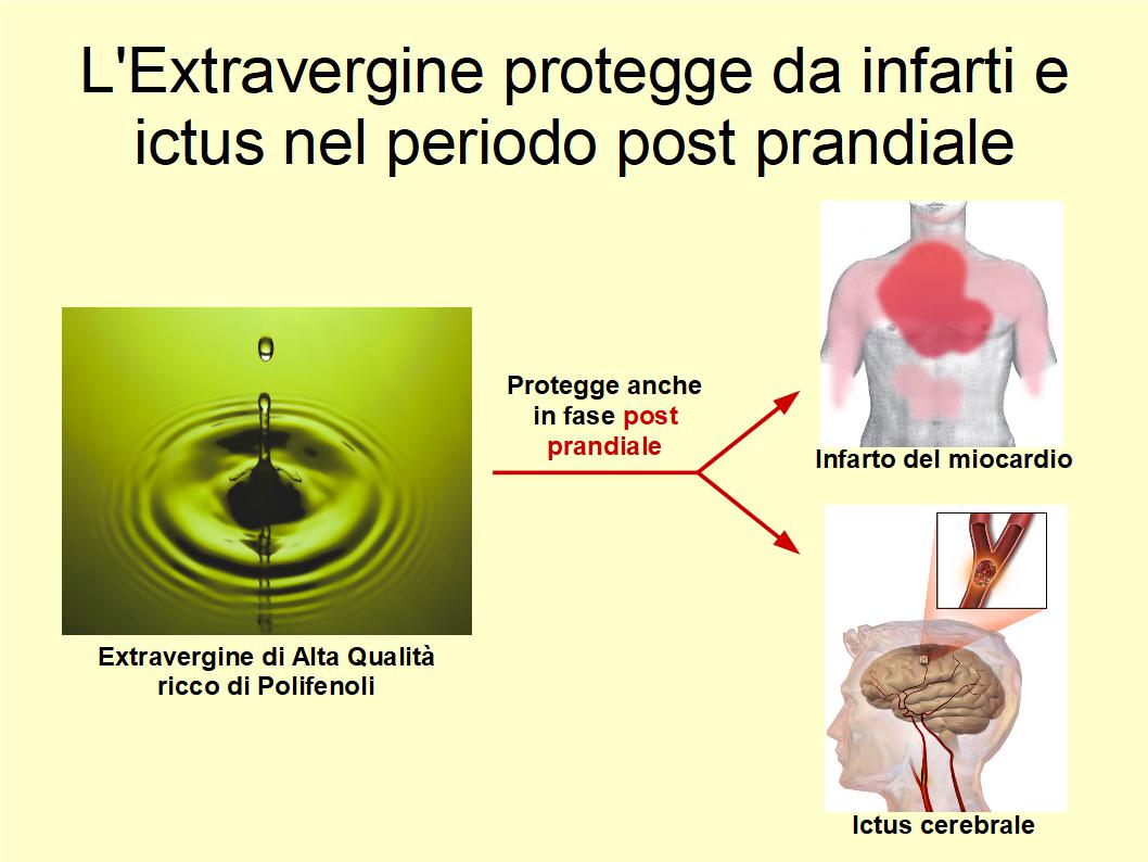 L’Extravergine è in grado di diminuire il rischio di Ictus e Infarti in fase post prandiale