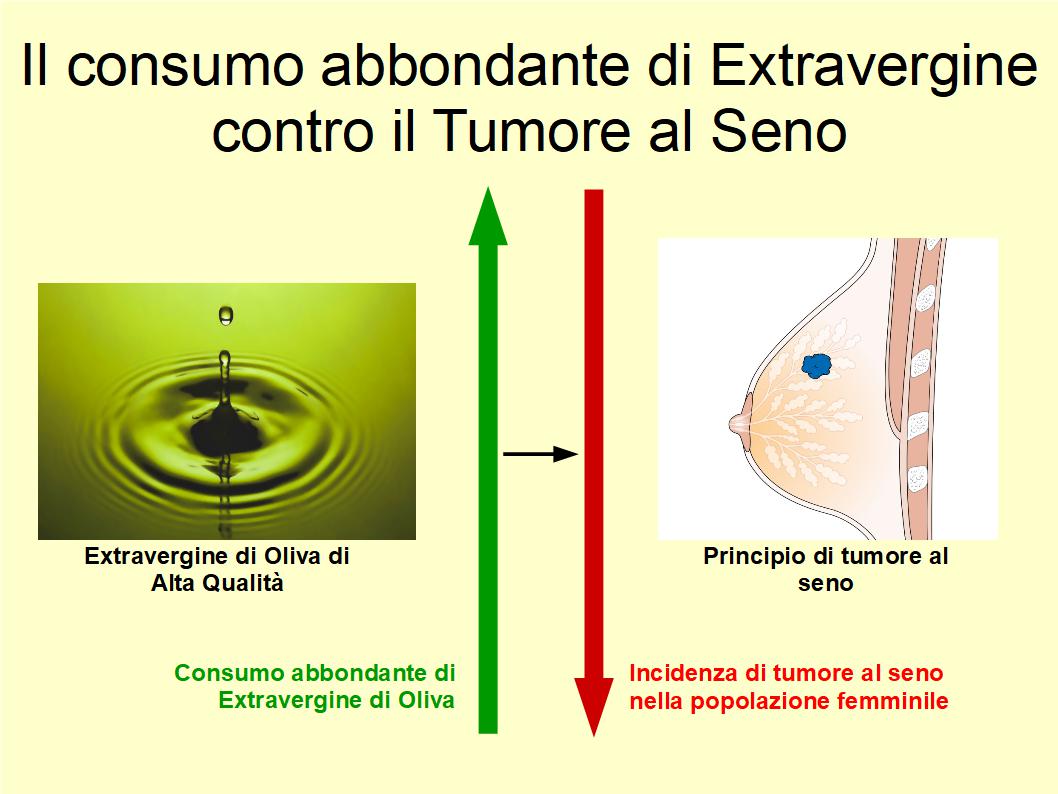 L'uso regolare di Extravergine riduce l'incidenza del tumore al seno
